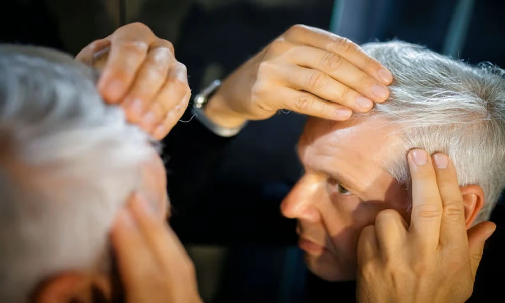 Hair-Loss Clinics Should Explain the Why Before the Product
